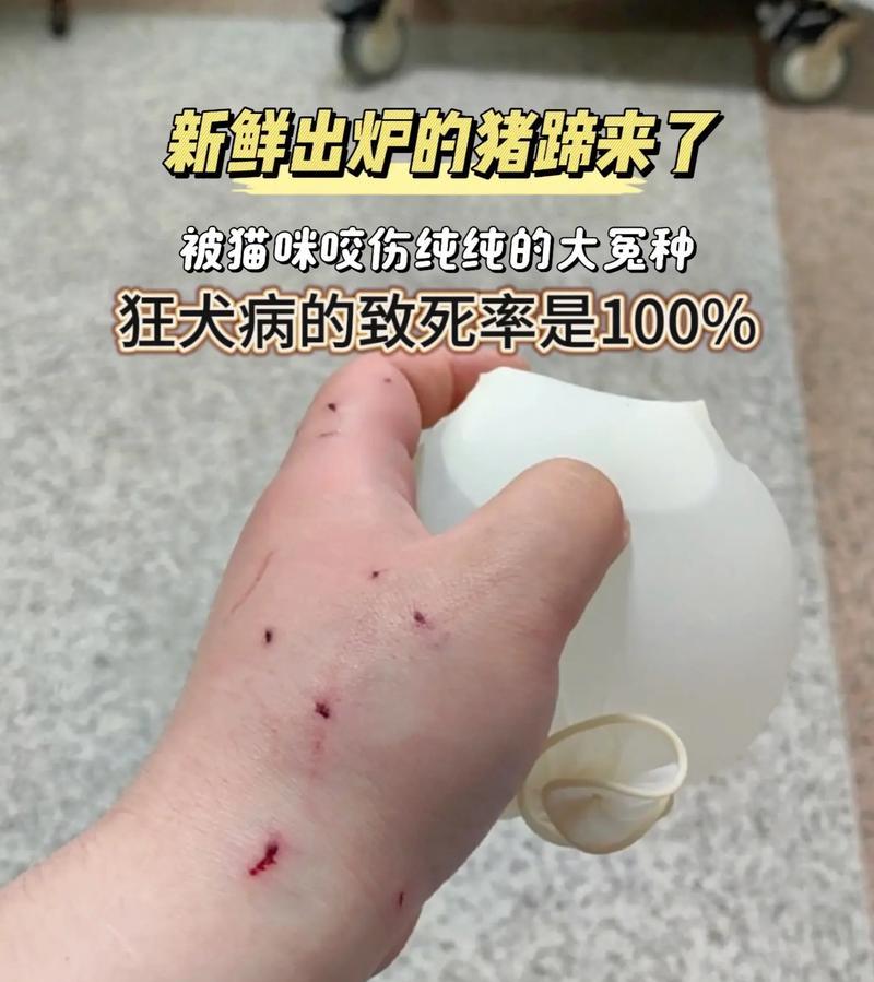 正确处理被无意间抓伤咬伤的方法（保护自己安全、正确处理伤口，迅速寻求医疗救助）