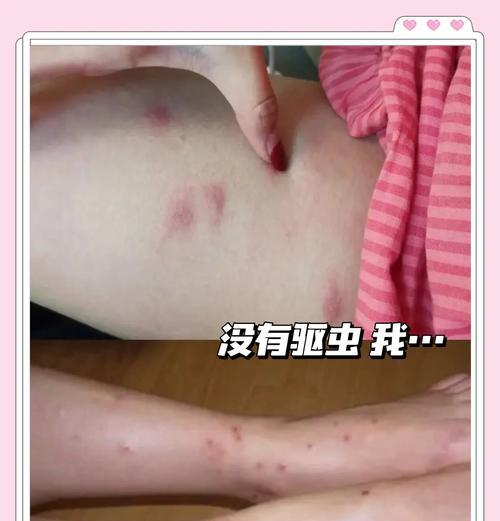 揭秘狗狗跳蚤的栖息地（探寻狗狗身上和家中哪些地方是跳蚤的宝藏地）