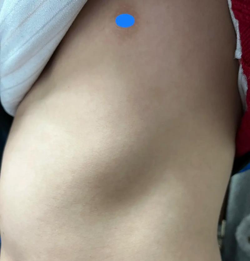探讨狗狗肋骨畸形的原因、诊断与治疗（了解狗狗肋骨畸形对其健康的影响及如何预防）