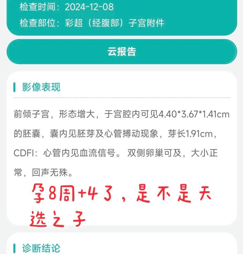 怀孕60天的反应及注意事项（了解孕早期症状，保护宝宝健康成长）