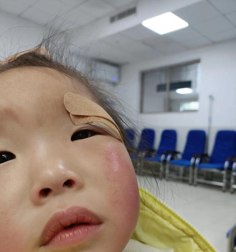 狗狗内脏受伤能活几天？（探究狗狗内脏受伤的存活时间及应对策略）