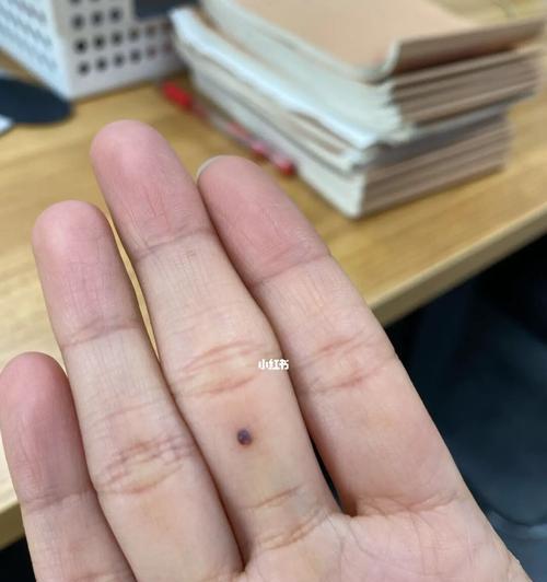 狗内出血（揭示狗内出血的存活时间及应对方法）